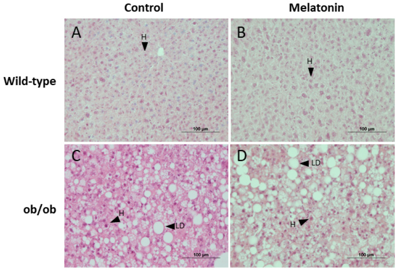 Melatonin Alleviates Liver Mitochondrial Dysfunction in Leptin-Deficient Mice